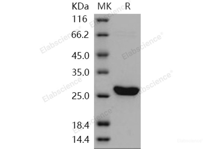 Recombinant Human UCHL3 / UCH-L3 Protein (His tag)-Elabscience