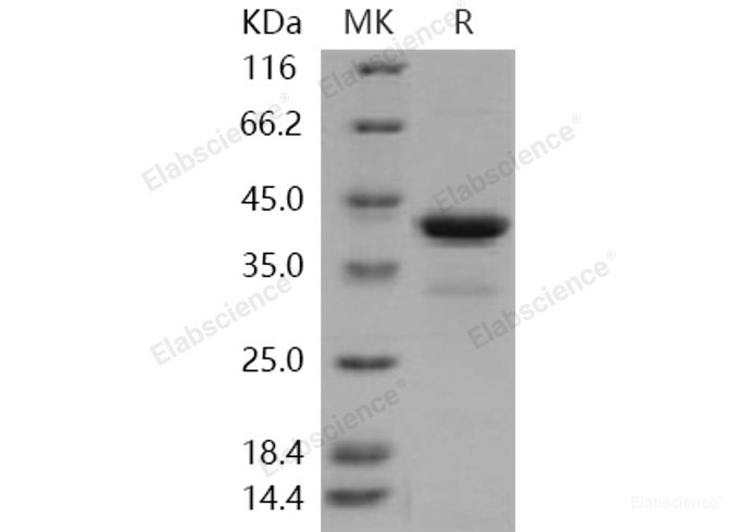 Recombinant Human PCBP1 Protein (His tag)-Elabscience