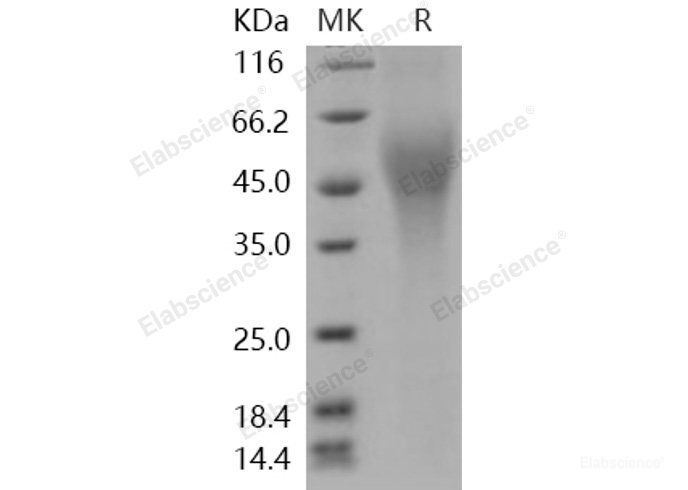 Recombinant Human CD200R1L / CD200R2 / CD200RLa Protein (His tag)-Elabscience