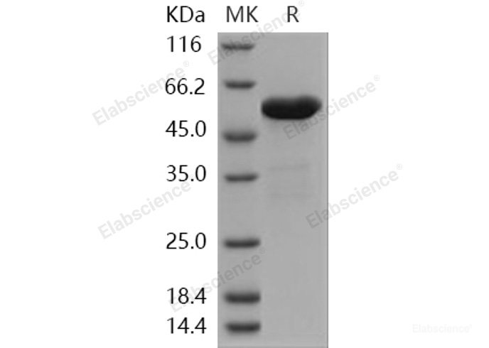 Recombinant Human ALDH7A1 / ATQ1 Protein (His tag)-Elabscience