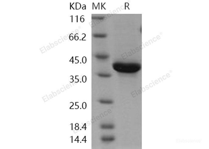 Recombinant Human NRG1-beta 1 Protein (EGF Domain, Fc tag)-Elabscience