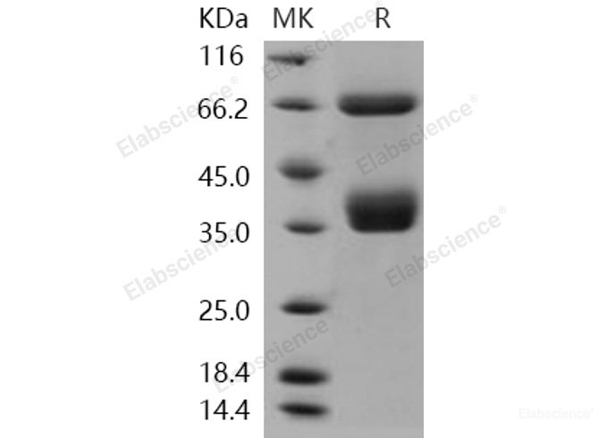 Recombinant Human CD136 / MST1R Protein (His tag)-Elabscience