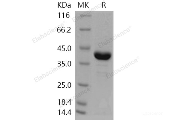 Recombinant Human AKR1A1 Protein (His tag)-Elabscience