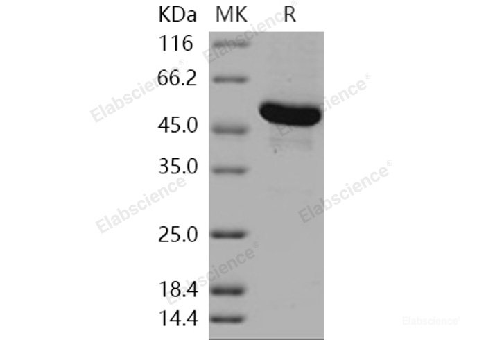 Recombinant Human GBA3 / CBGL1 Protein (His tag)-Elabscience