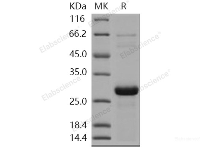 Recombinant Human SNAP25 / SUP Protein (His tag)-Elabscience