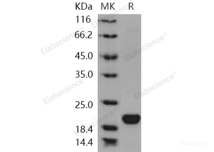 Recombinant Human LCN1 / VEGP / Lipocalin-1 Protein (His tag)-Elabscience