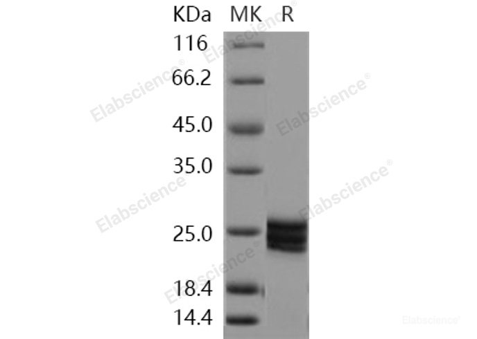 Recombinant Human ESM1 / Endocan Protein (His tag)-Elabscience