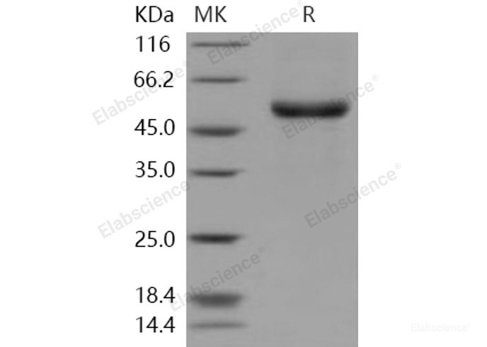 Recombinant Human EDAR / DL Protein (Fc tag)-Elabscience