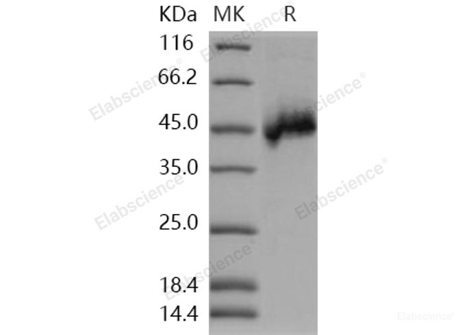 Recombinant Human NETO1 / BTCL1 Protein (His tag)-Elabscience