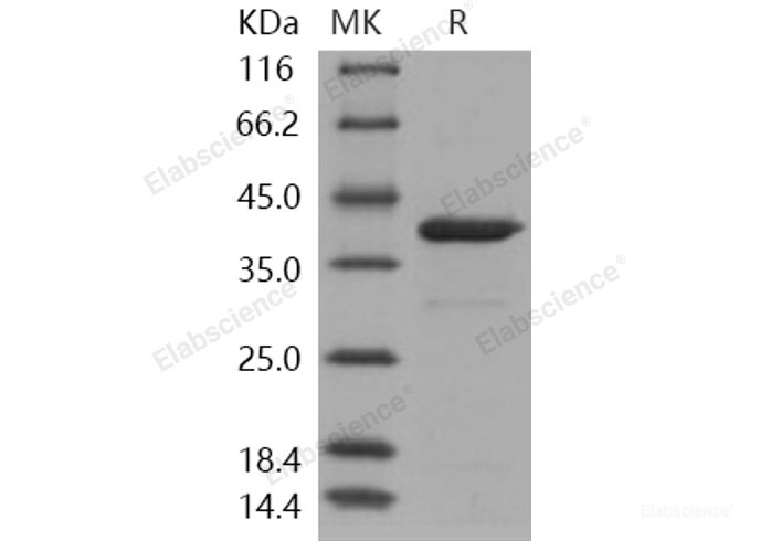 Recombinant Human ARG1 / Arginase 1 Protein (His tag)-Elabscience