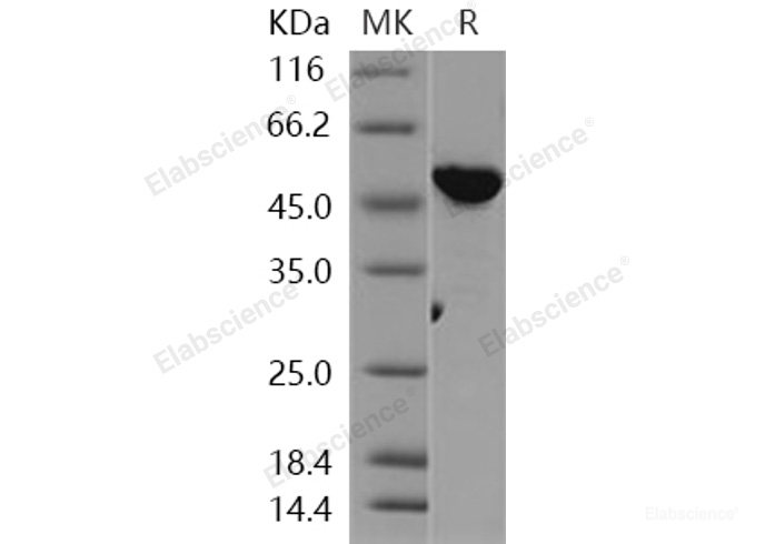 Recombinant Human VRK1 Protein-Elabscience