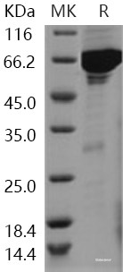 Recombinant Human VRK1 Protein (His & GST tag)-Elabscience