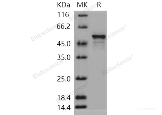 Recombinant Human DOT1L / KMT4 Protein-Elabscience