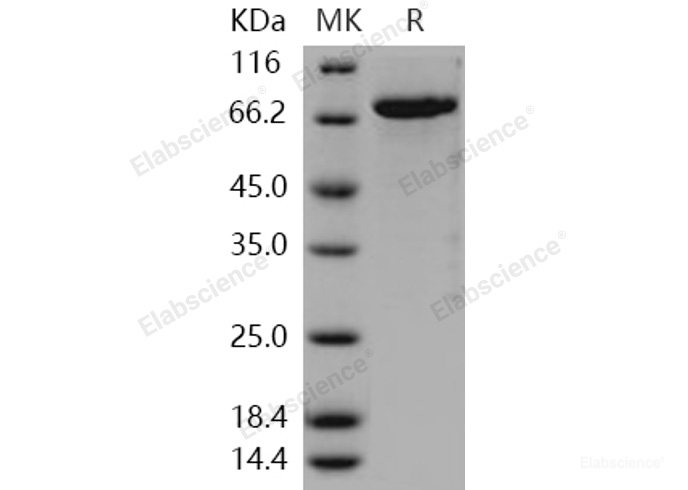 Recombinant Human CDC42BPB Protein (His & GST tag)-Elabscience