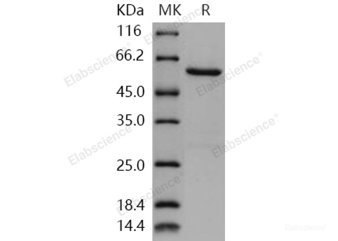 Recombinant Human NEK7 Protein (His & GST tag)-Elabscience
