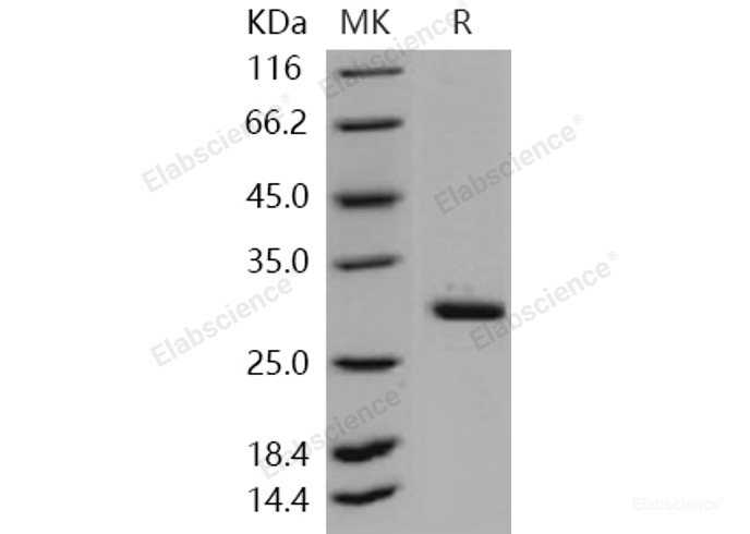 Recombinant Human METTL1 Protein (His tag)-Elabscience