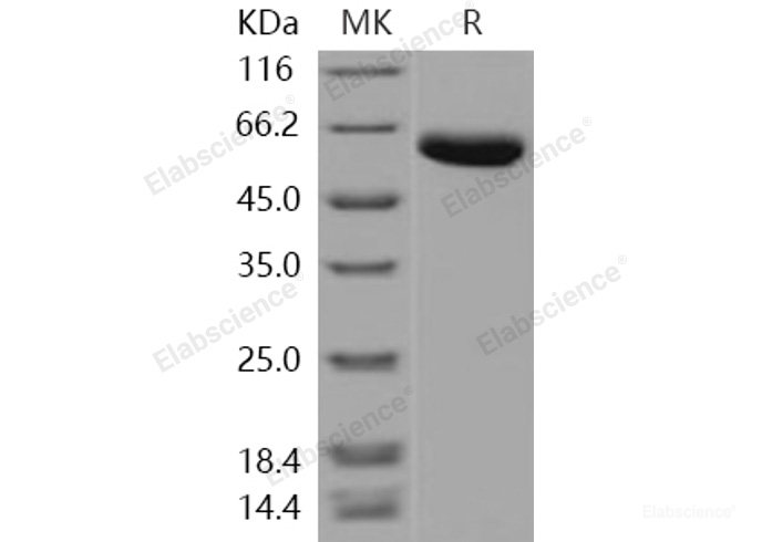 Recombinant Human Carboxypeptidase B2 / CPB2 Protein (His tag)-Elabscience