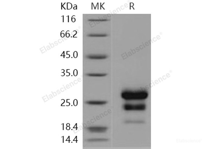 Recombinant Human CLEC4D / CLECSF8 Protein (His tag)-Elabscience