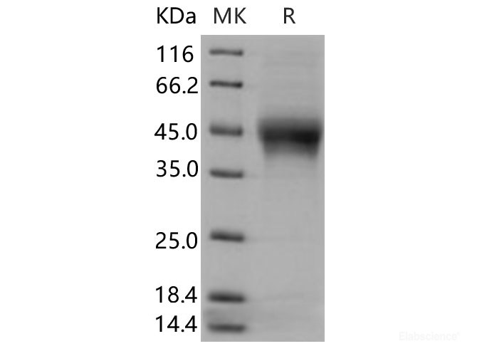 Recombinant Human IL21 Receptor Protein (His Tag)-Elabscience