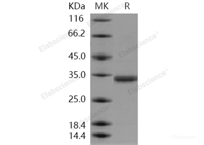 Recombinant Human CMA1 / Chymase 1 Protein (His tag)-Elabscience