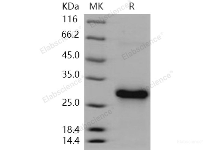 Recombinant Human CLEC4A / CLECSF6 / DCIR Protein (His tag)-Elabscience
