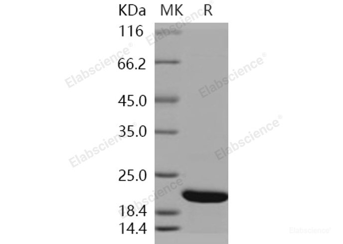 Recombinant Human CFL2 / cofilin 2 / ADF Protein (His tag)-Elabscience