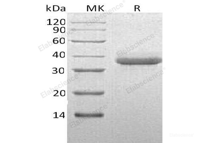 Recombinant Human Chymotrypsin C Protein (His Tag)-Elabscience