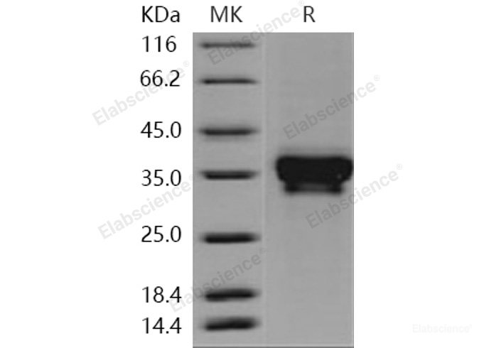 Recombinant Human STIM1 / GOK Protein (His tag)-Elabscience