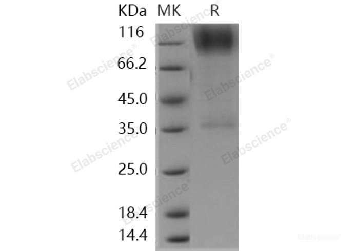 Recombinant Human B3GNT2 Protein (Fc tag)-Elabscience