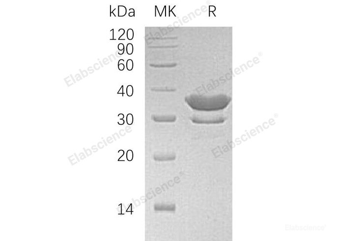 Recombinant Human SULT2A1 Protein (His Tag)-Elabscience