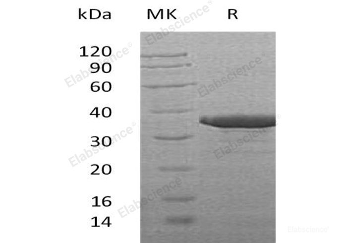 Recombinant Human SULT2B1 Protein (His Tag)-Elabscience