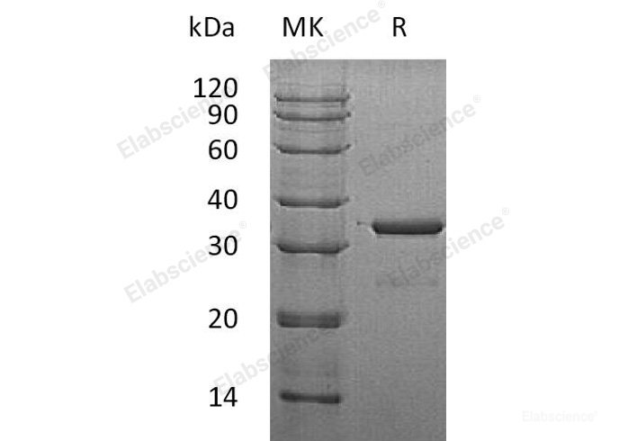 Recombinant Human SULT1A3 Protein (His Tag)-Elabscience