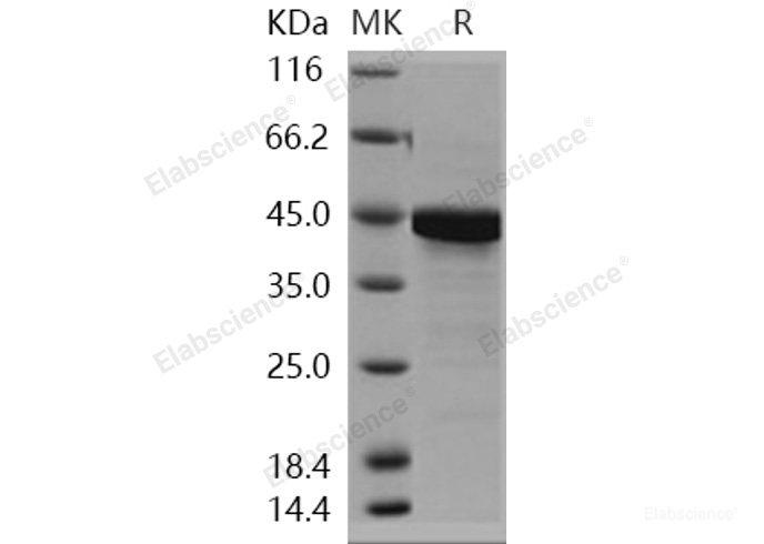 Recombinant Human PTMA Protein (GST tag)-Elabscience