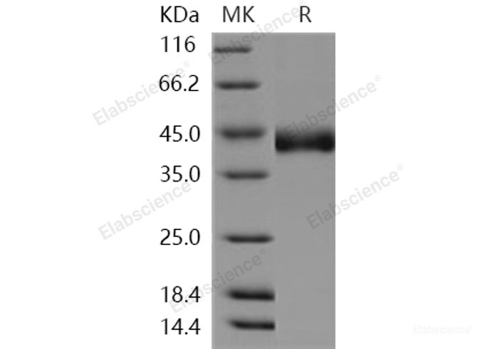Recombinant Human CHST11 / C4ST-1 Protein (His tag)-Elabscience