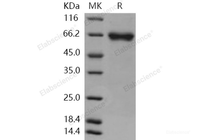 Recombinant Human LRRTM4 Protein (His tag)-Elabscience