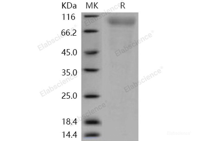 Recombinant Human CD180 / RP105 / LY64 Protein (His tag)-Elabscience