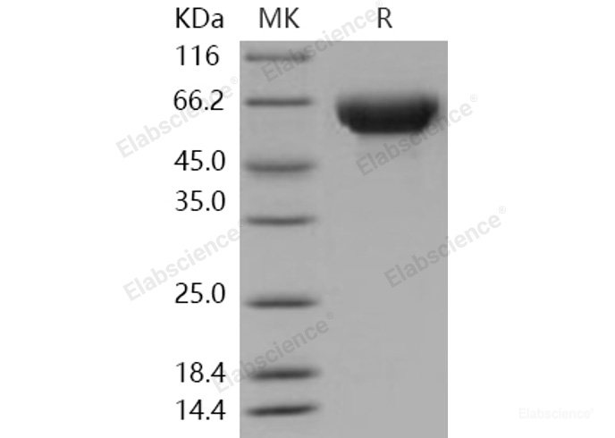 Recombinant Human ORP150 / HYOU1 / HSP12A Protein (His tag)-Elabscience