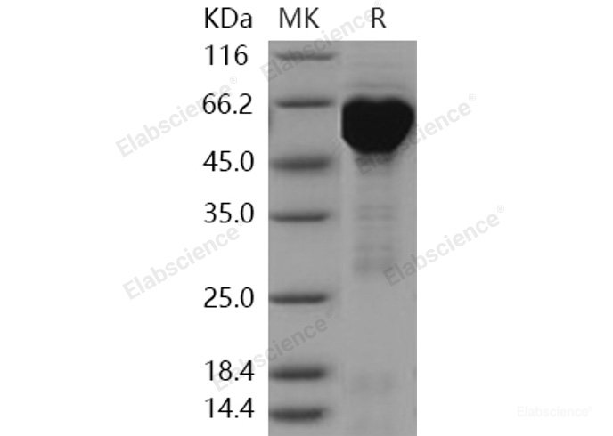 Recombinant Human HSPD1 / HSP60 Protein (His & GST tag)-Elabscience
