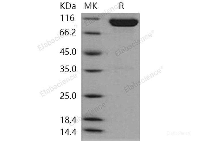 Recombinant Human EphA4 Protein (His & Fc tag)-Elabscience