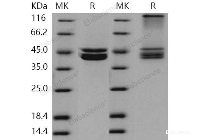 Recombinant Human PRMT6 / HRMT1L6 Protein (His & FLAG tag)-Elabscience