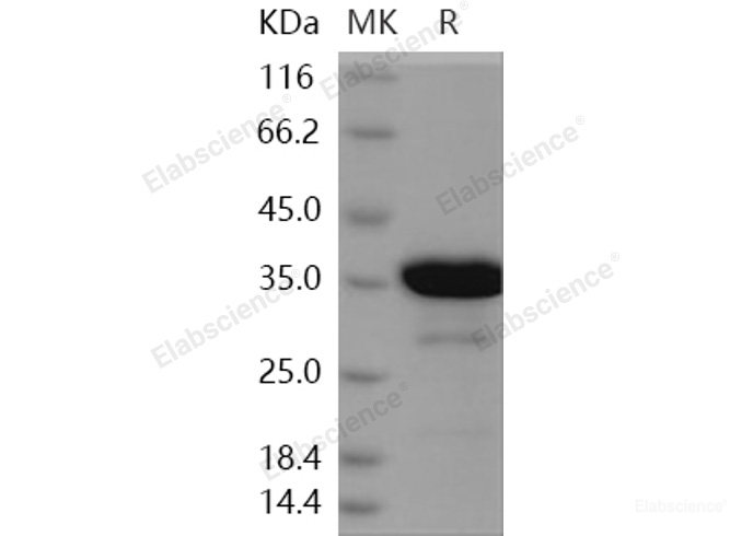 Recombinant Human SAA4 Protein (GST tag)-Elabscience