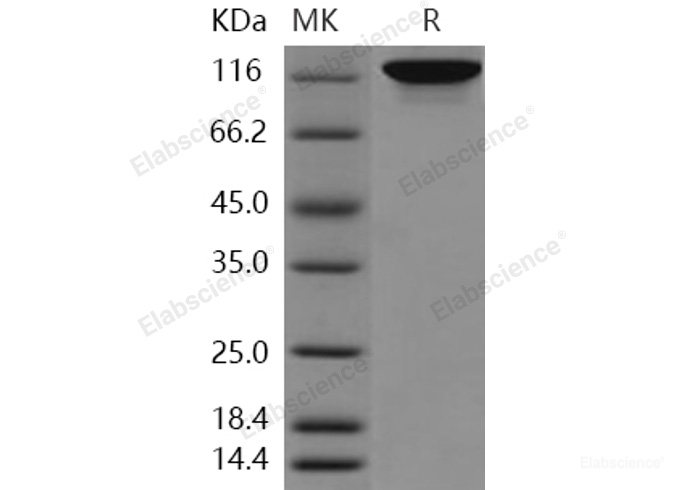Recombinant Human Autotaxin / ENPP2 / NPP2 Protein (His tag)-Elabscience