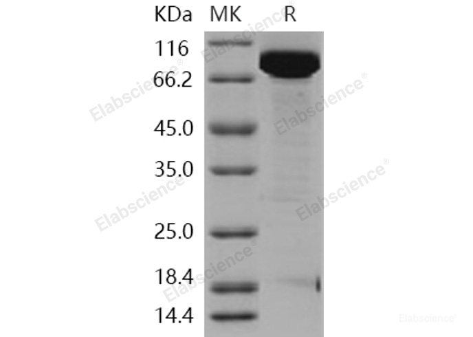 Recombinant Human EED / Embryonic Ectoderm Development Protein (His & GST tag)-Elabscience