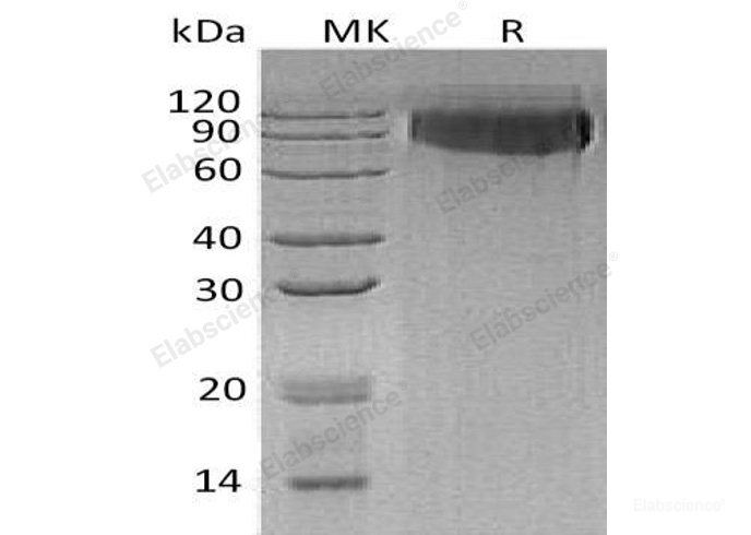 Recombinant Human GPNMB Protein (His Tag)-Elabscience