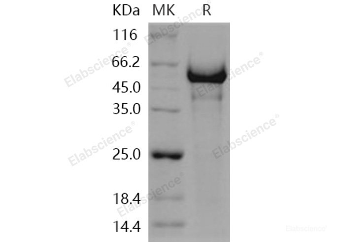 Recombinant Human Semaphorin 5A / SEMA5A Protein (His tag)-Elabscience