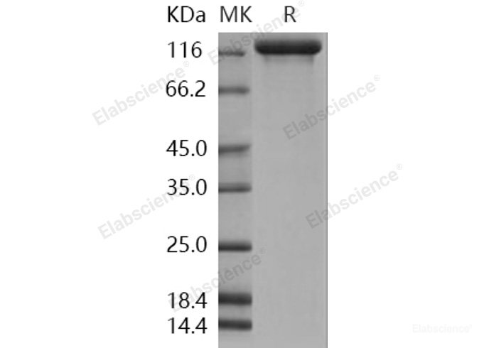Recombinant Human Semaphorin 5A / SEMA5A Protein (Fc tag)-Elabscience