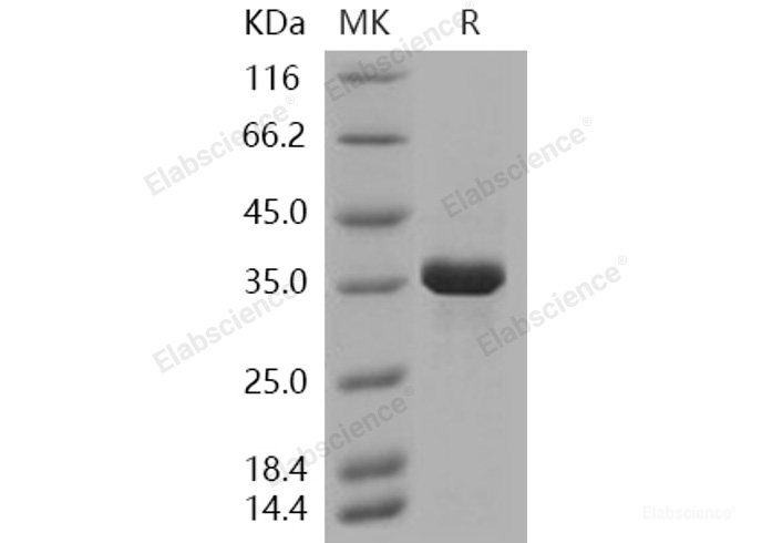 Recombinant Human AKR1B1 Protein (His tag)-Elabscience
