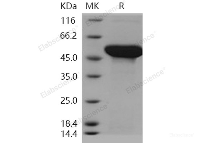 Recombinant Human ADSL / Adenylosuccinate Lyase Protein (His tag)-Elabscience