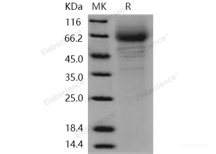 Recombinant Human CD97 Protein (His tag)-Elabscience