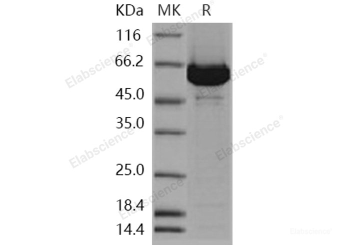 Recombinant Human ACOX1 / aox Protein (His tag)-Elabscience